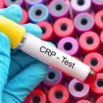 CRP hodnoty: Kdy jsou v pořádku a kdy ne?