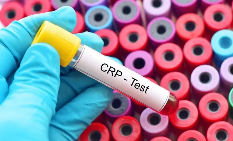 CRP hodnoty: Kdy jsou v pořádku a kdy ne?
