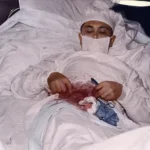 Leonid Rogozov: Appendektomie na Antarktidě