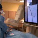 Co je to mrtvice aneb Cévní mozková příhoda? (Od A do Z) ✅