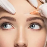 Botox bez mýtů: Moje zkušenost, tipy i upřímná fakta