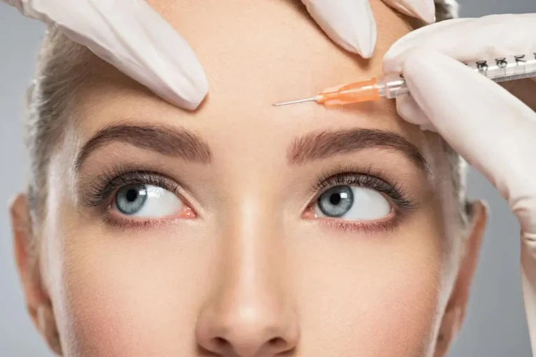 Botox bez mýtů: Moje zkušenost, tipy i upřímná fakta