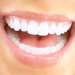 Zářivý úsměv bez zubaře? Ultrasonický čistič zubů TrueSonic