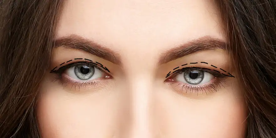 vicka praha | Venclíkovi.cz Detail očí s naznačenými liniemi pro plastiku horních víček